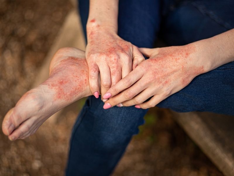 mantarlar-vucutta-baslica