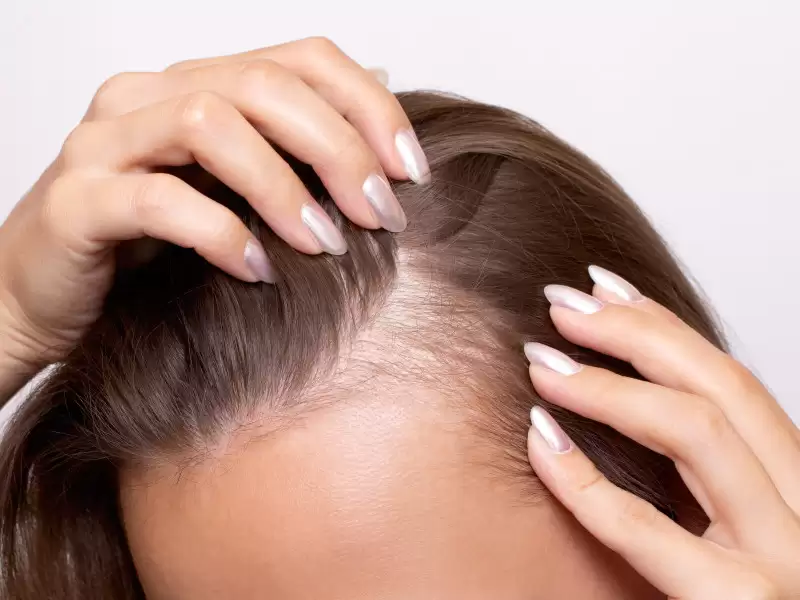 sac-ve-tirnak-hastaliklari